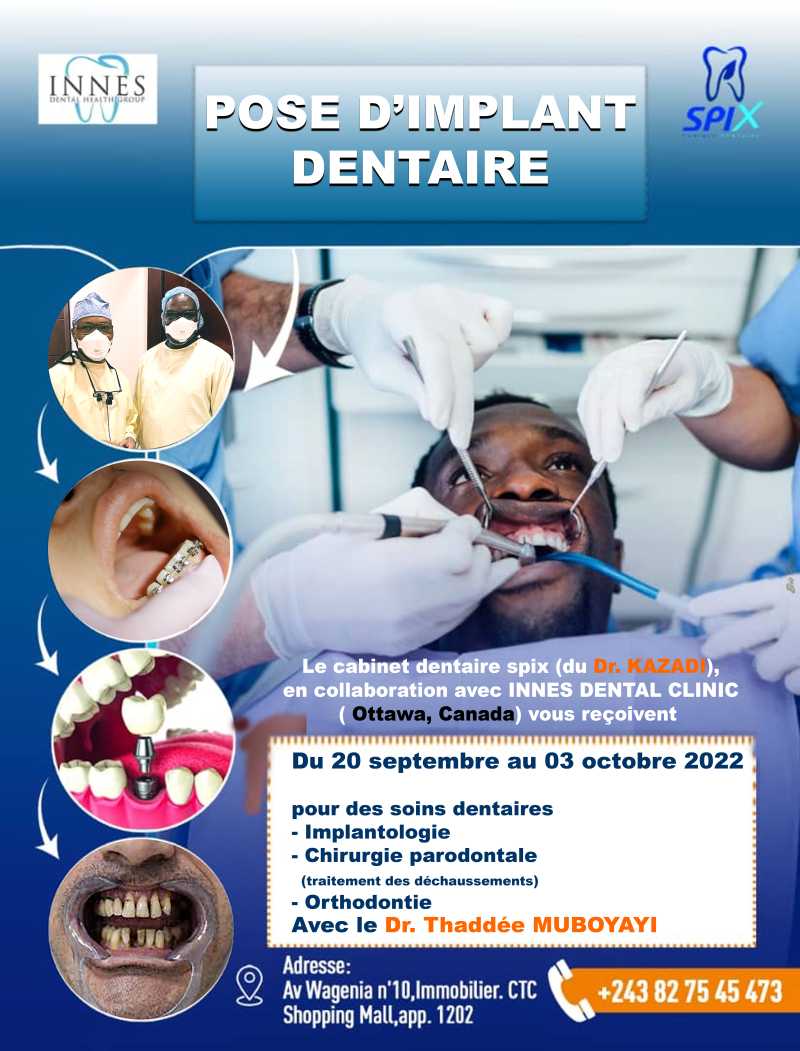 POSE IMPLANT DENTAIRE +24382 75 45 473 SPIX CABINET DENTAIRE